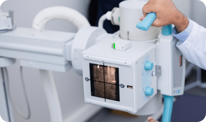 デジタルX線装置の画像