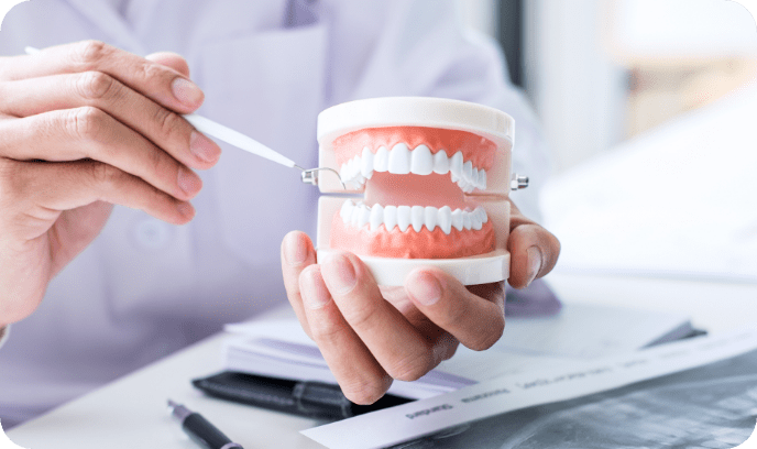 歯の模型の画像