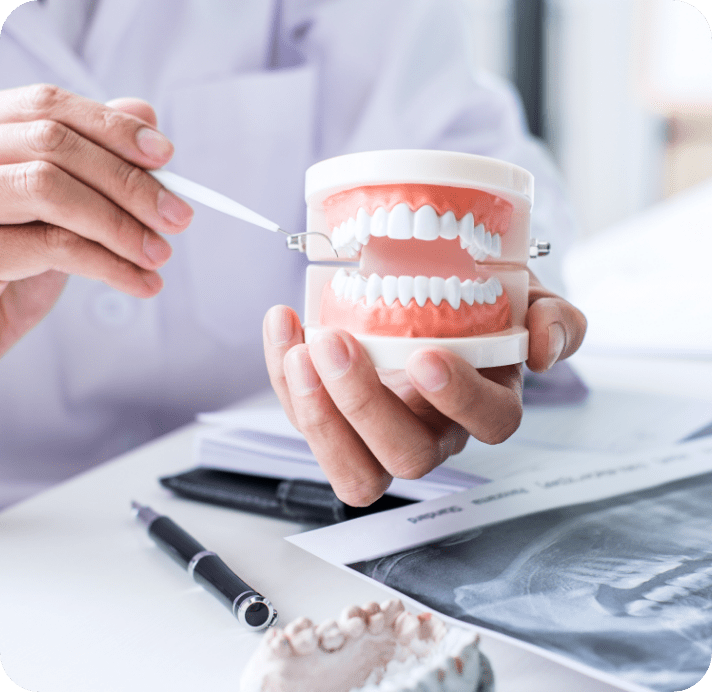 歯の模型の画像