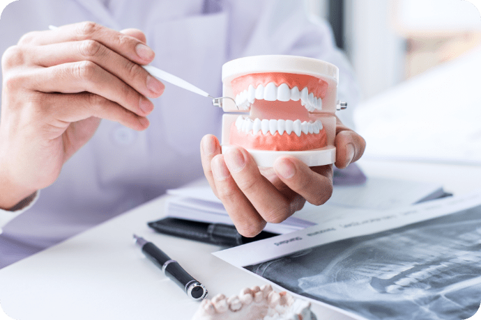 歯の模型の画像